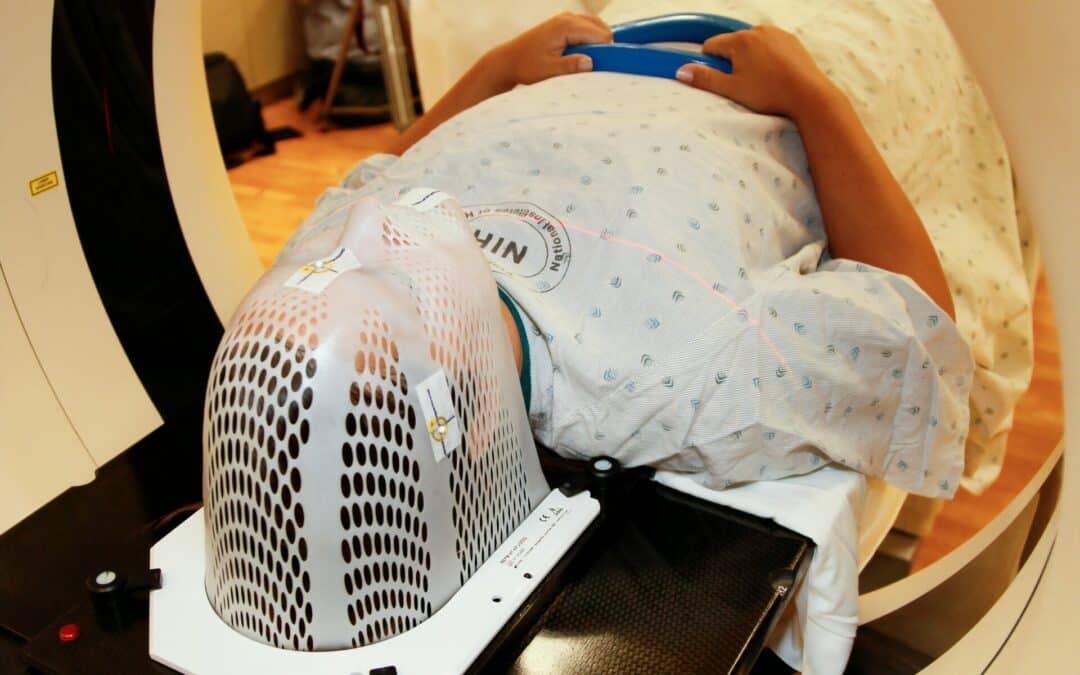 Lungcancerscreening kan rädda upp till 500 liv om året