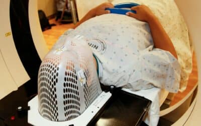 Lungcancerscreening kan rädda upp till 500 liv om året